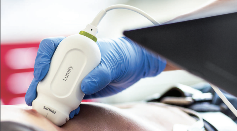 Philips Lumify